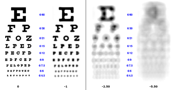 monolid-eyes-vs-hooded-eyes-how-do-they-differ